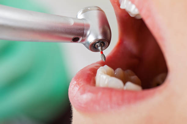 Best Emergency Broken Tooth Repair in Landover, MD